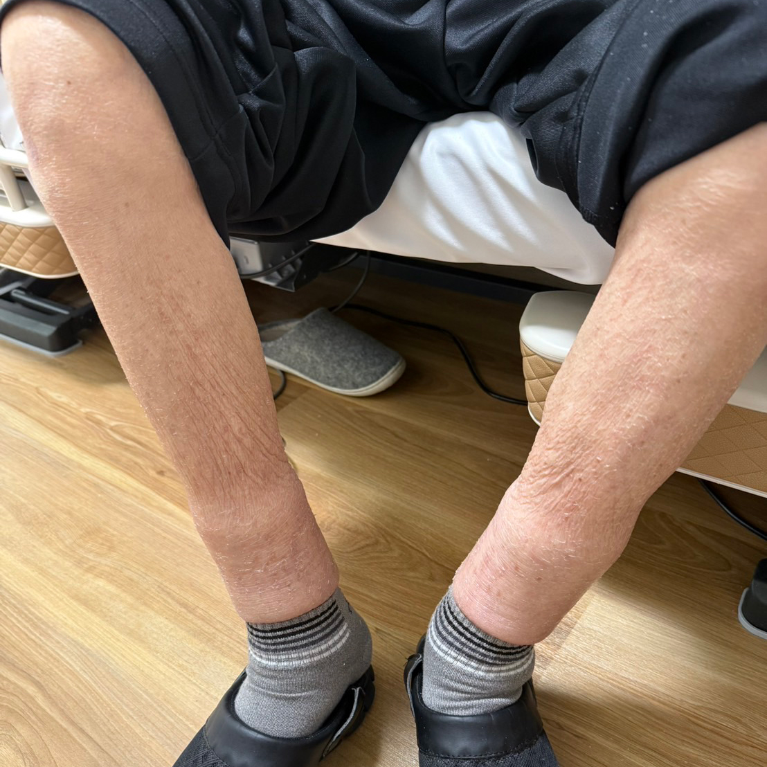 施術後の状態（80代男性）